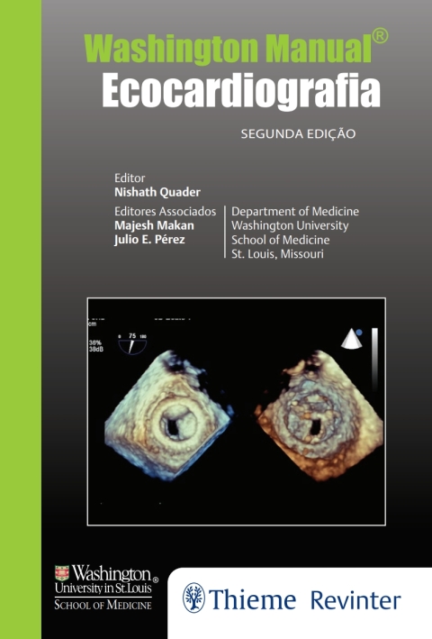 Cover image for book Ecocardiografia. (Washington Manual®)