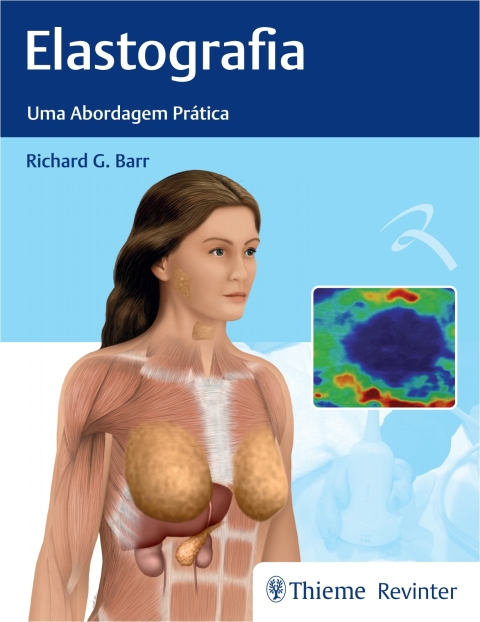 Cover image for book Elastografia: Uma Abordagem Prática Capa
