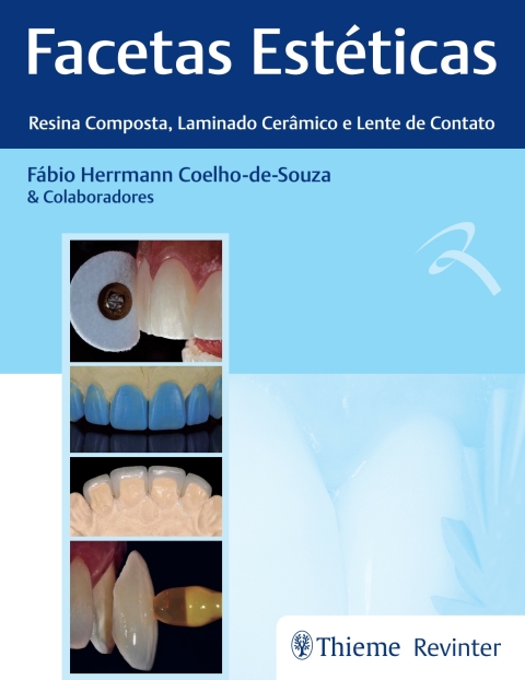 Cover image for book Facetas Estéticas: Resina Composta, Laminado Cerâmico e Lente de Contato