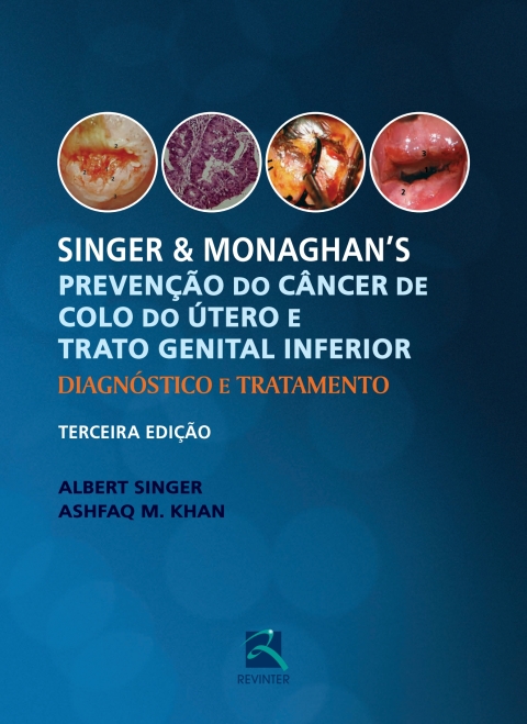 Cover image for book Singer e Monaghan's: Prevenção do Câncer de Colo do Útero e  Trato Genital Inferior: Diagnóstico e Tratamento
