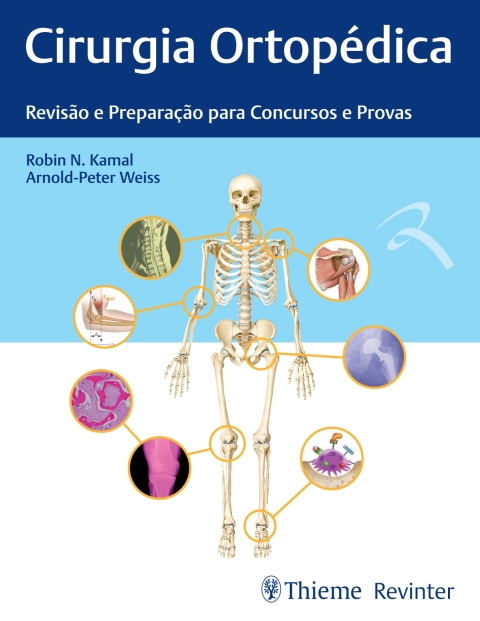 Cover image for book Cirurgia Ortopédica: Revisão e Preparação para Concursos e Provas