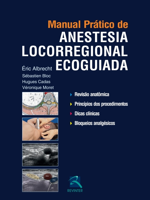 Cover image for book Manual Prático de Anestesia Locorregional Ecoguiada