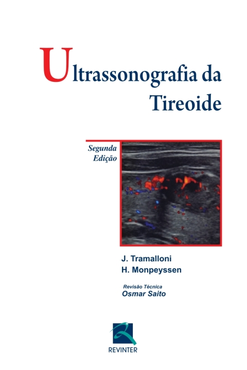 Cover image for book Ultrassonografia da Tireoide