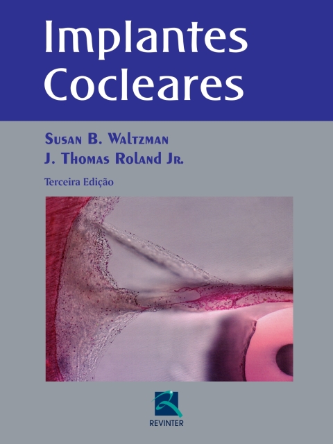 Cover image for book Implantes Cocleares