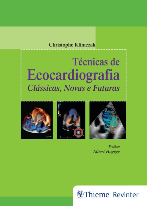 Cover image for book Técnicas de Ecocardiografia: Clássicas, Novas e Futuras