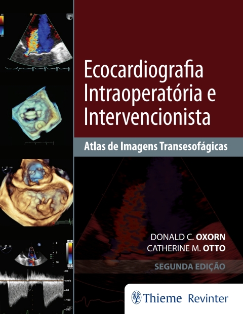 Cover image for book Ecocardiografia Intraoperatória e Intervencionista: Atlas de Imagens Tansesofágicas