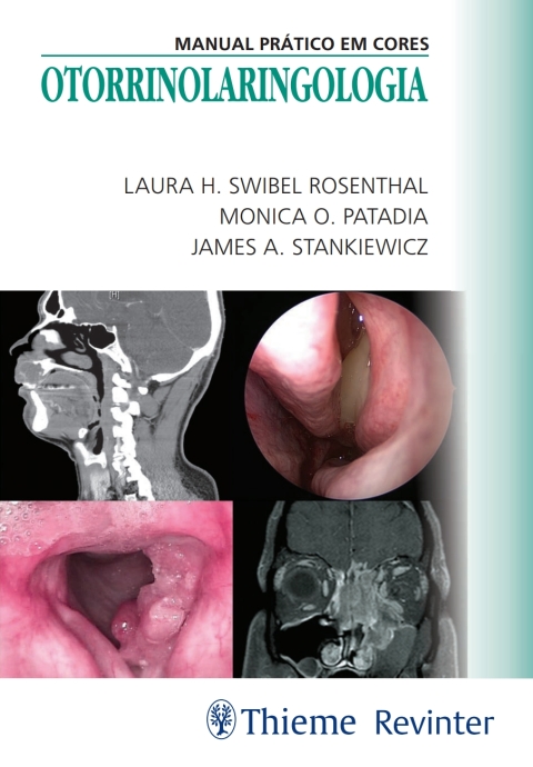 Cover image for book Otorrinolaringologia: Manual Prático em Cores