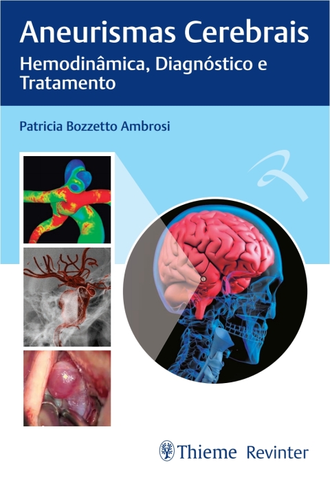 Cover image for book Aneurismas Cerebrais: Hemodinâmica, Diagnóstico e Tratamento