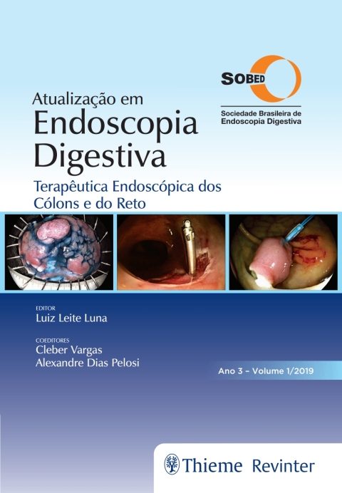 Cover image for book Atualização em Endoscopia Digestiva: Terapêutica Endoscópica dos Cólons e do Reto