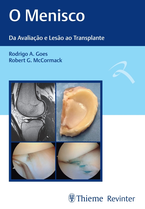 Cover image for book O Menisco: Da Avaliação e Lesão ao Transplante
