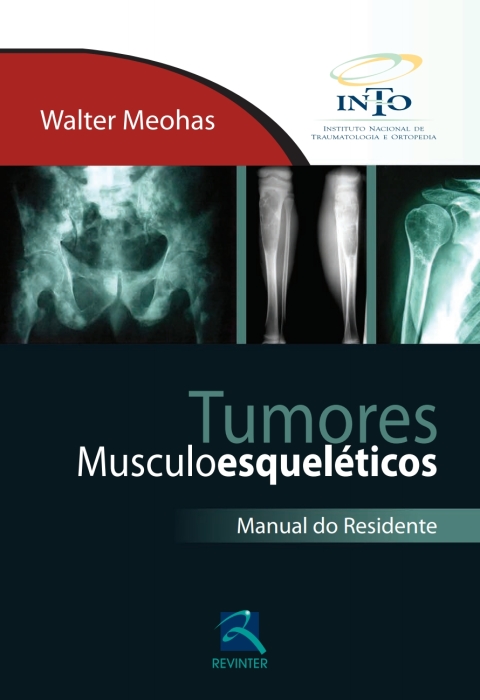 Cover image for book Tumores Musculoesqueléticos: Manual do Residente