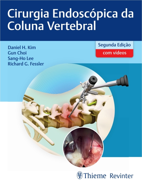 Cover image for book Cirurgia Endoscópica da Coluna Vertebral
