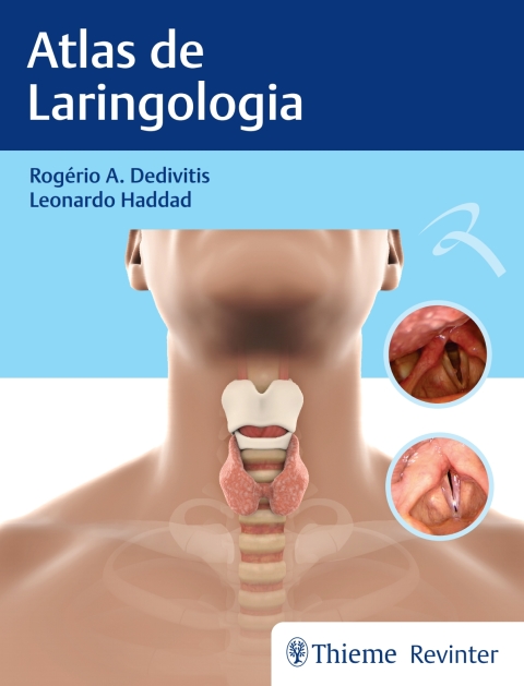 Cover image for book Atlas de Laringologia