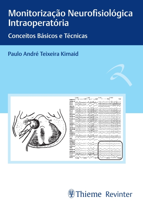 Cover image for book Monitorização Neurofisiológica Intraoperatória: Conceitos Básicos e Técnicas