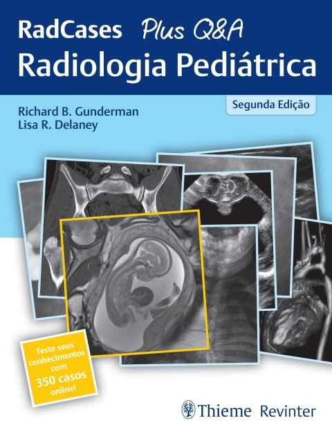 Cover image for book RedCases Plus Q&A Radiologia Pediátrica: RadCases + Q&A