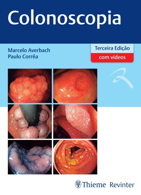 Cover image for book Colonoscopia