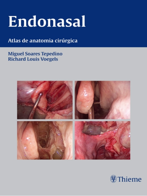 Cover image for book Endonasal: Atlas de Anatomia Cirúrgica
