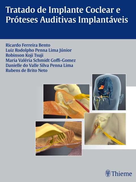 Cover image for book Tratado de Implante Coclear e Próteses Auditivas Implantáveis
