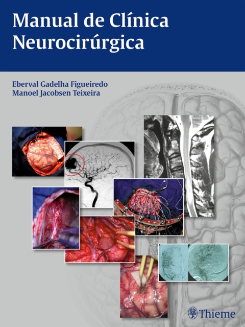 Cover image for book Manual de Clínica Neurocirúrgica