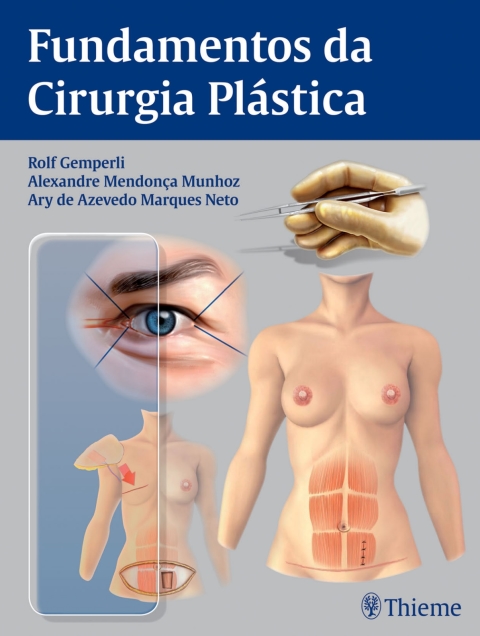 Cover image for book Fundamentos da Cirurgia Plástica