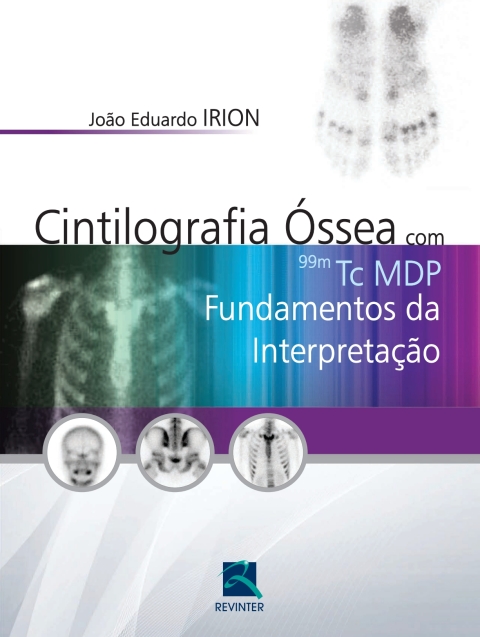 Cover image for book Cintilografia Óssea com 99M Tc  MDP: Fundamentos da Interpretação