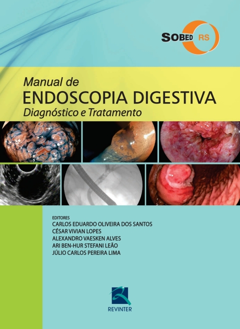 Cover image for book Manual de Endoscopia Digestiva: Diagnóstico e Tratamento