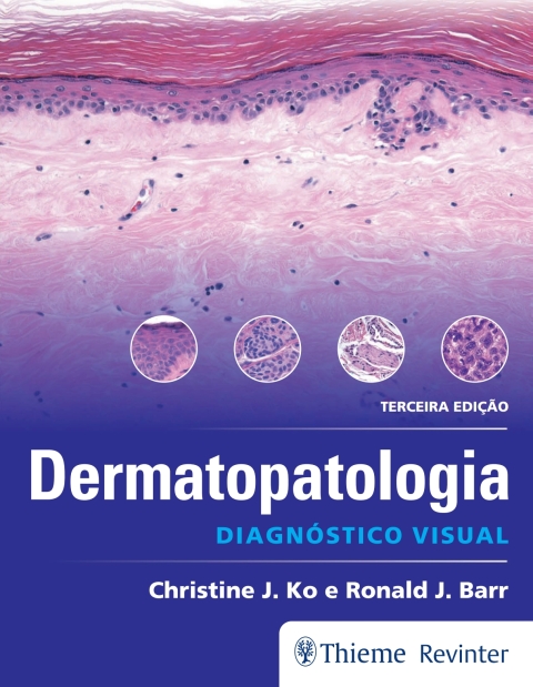 Cover image for book Dermatopatologia: Diagnóstico Visual