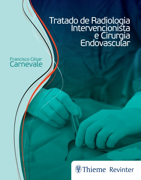 Cover image for book Tratado de Radiologia Intervencionista e Cirurgia Endovascular