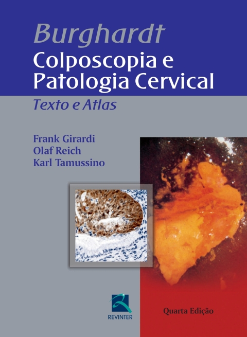 Cover image for book Burghardt: Colposcopia e Patologia Cervical: Texto e Atlas