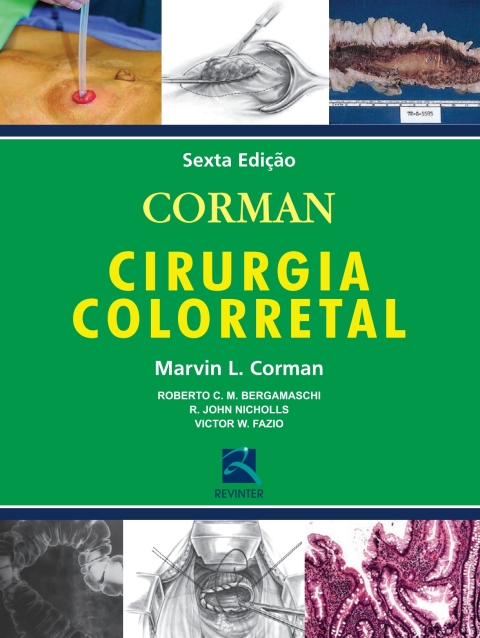 Cover image for book Corman: Cirurgia Colorretal