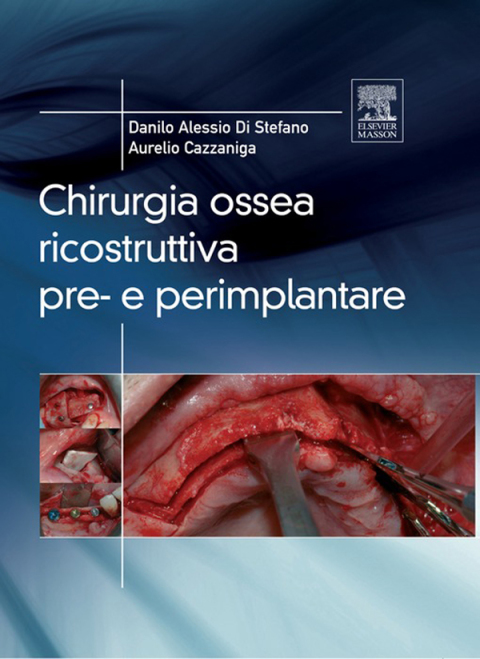 Cover image for book Chirurgia ossea ricostruttiva pre-e perimplantare