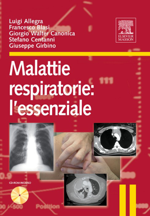 Cover image for book MALATTIE RESPIRATORIE: L’ESSENZIALE