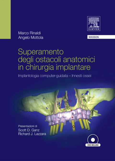 Cover image for book SUPERAMENTO DEGLI OSTACOLI ANATOMICI IN CHIURGIA IMPLANTARE