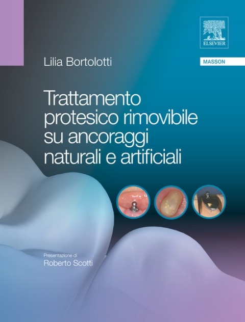 Cover image for book Trattamento protesico rimovibile su ancoraggi naturali e artificiali
