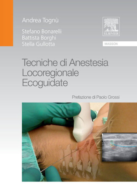 Cover image for book Tecniche di anestesia locoregionale ecoguidate