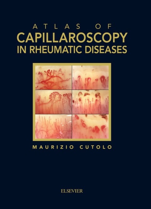 Cover image for book Atlas of Capillaroscopy in Rheumatic Diseases