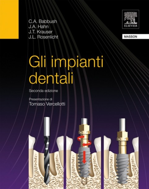 Cover image for book Gli impianti dentali