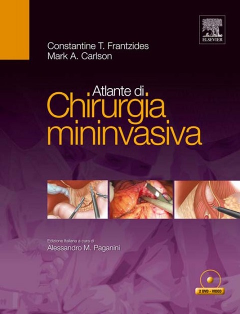 Cover image for book Atlante di chirurgia mininvasiva