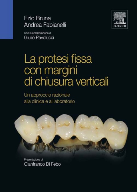 Cover image for book La protesi fissa con margini di chiusura verticali