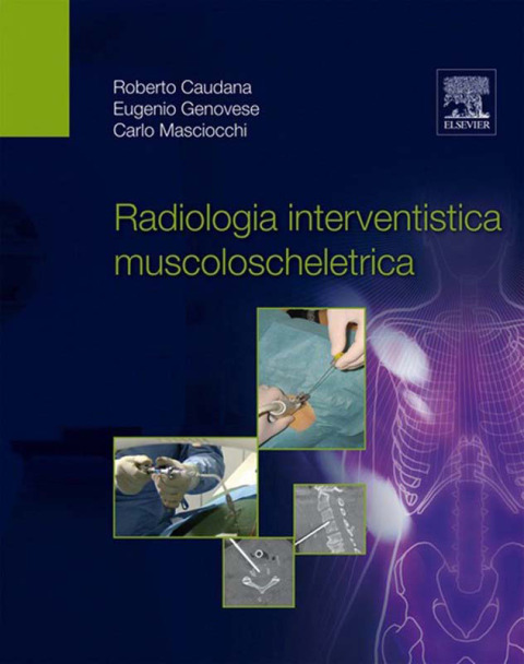 Cover image for book Radiologia interventistica muscoloscheletrica
