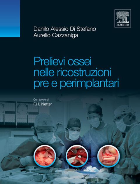 Cover image for book Prelievi ossei nelle ricostruzioni pre e perimplantari