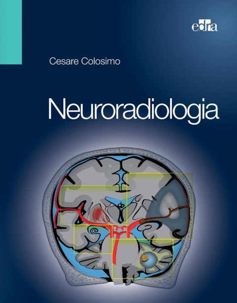 Cover image for book Neuroradiologia