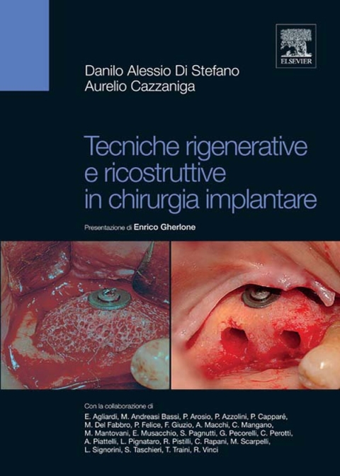 Cover image for book Tecniche rigenerative e ricostruttive in chirurgia implantare