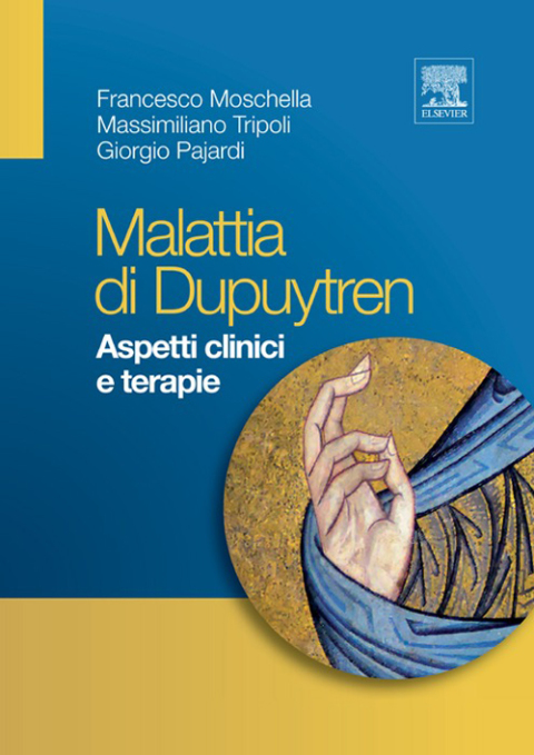 Cover image for book Malattia di Dupuytren
