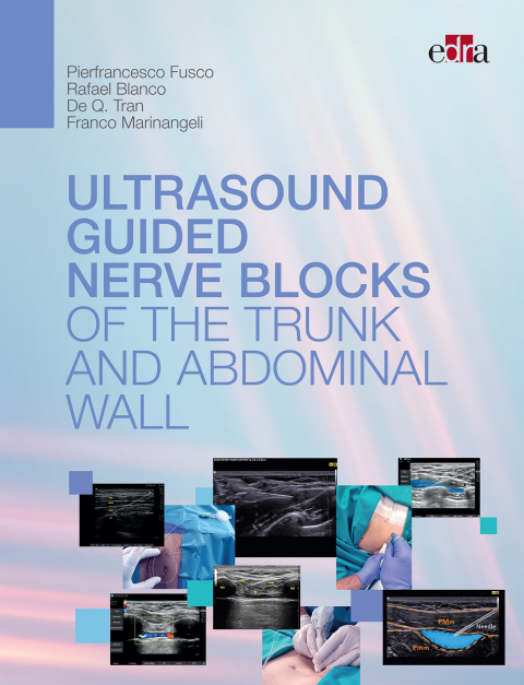 Ultrasoundguided nerve blocks of the trunk and abdominal wall 