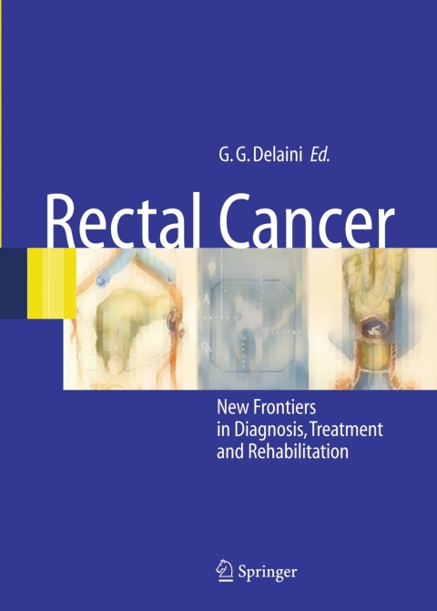 Cover image for book Rectal Cancer