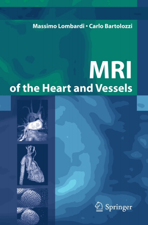 Cover image for book MRI of the Heart and Vessels