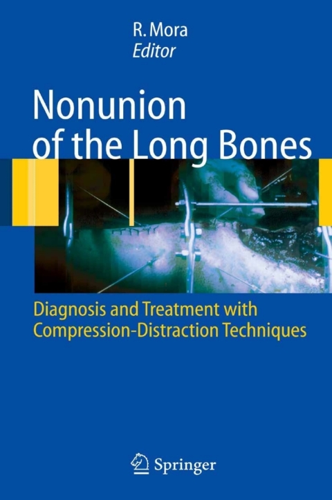 Cover image for book Nonunion of the Long Bones