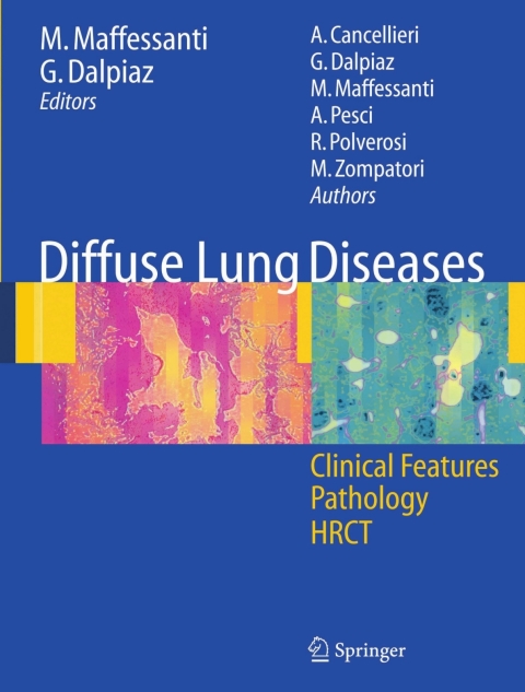 Cover image for book Diffuse Lung Diseases