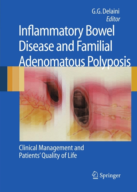 Cover image for book Inflammatory Bowel Disease and Familial Adenomatous Polyposis